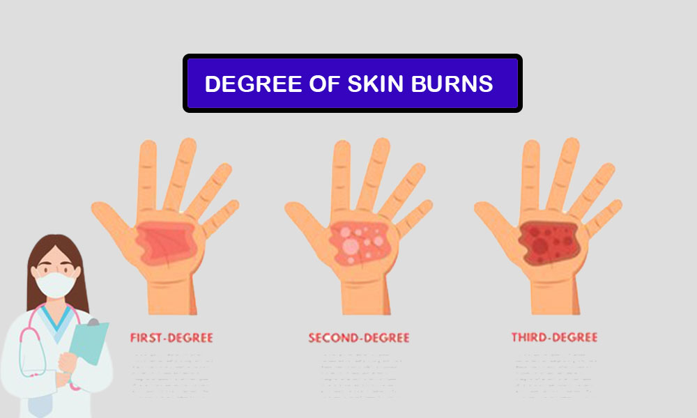 First Second and Third-Degree Burns